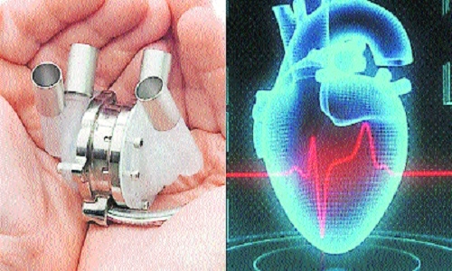 artificial heart