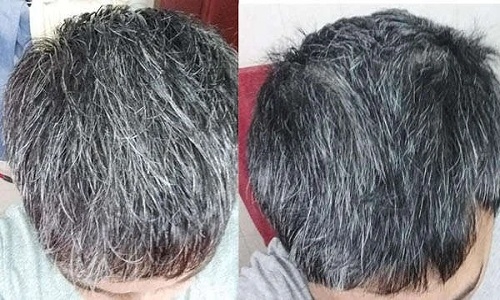 Grey hair 